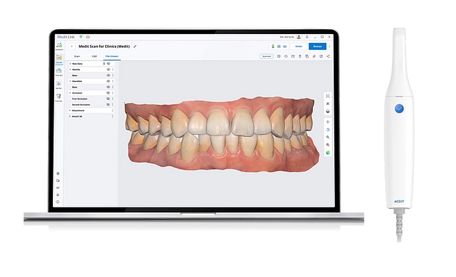 Intraoral Scanner Medit i500 Dental Clinics Solutions